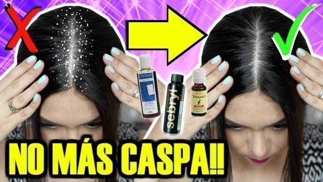 'EL MEJOR SHAMPOO PARA LA CASPA?? | MARIEBELLE COSMETICS'